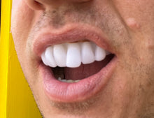 Assorted Teeth & Fangs - Single - The Scarborough Joke Shop