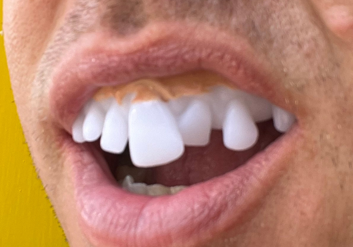 Assorted Teeth & Fangs (9 Pack)