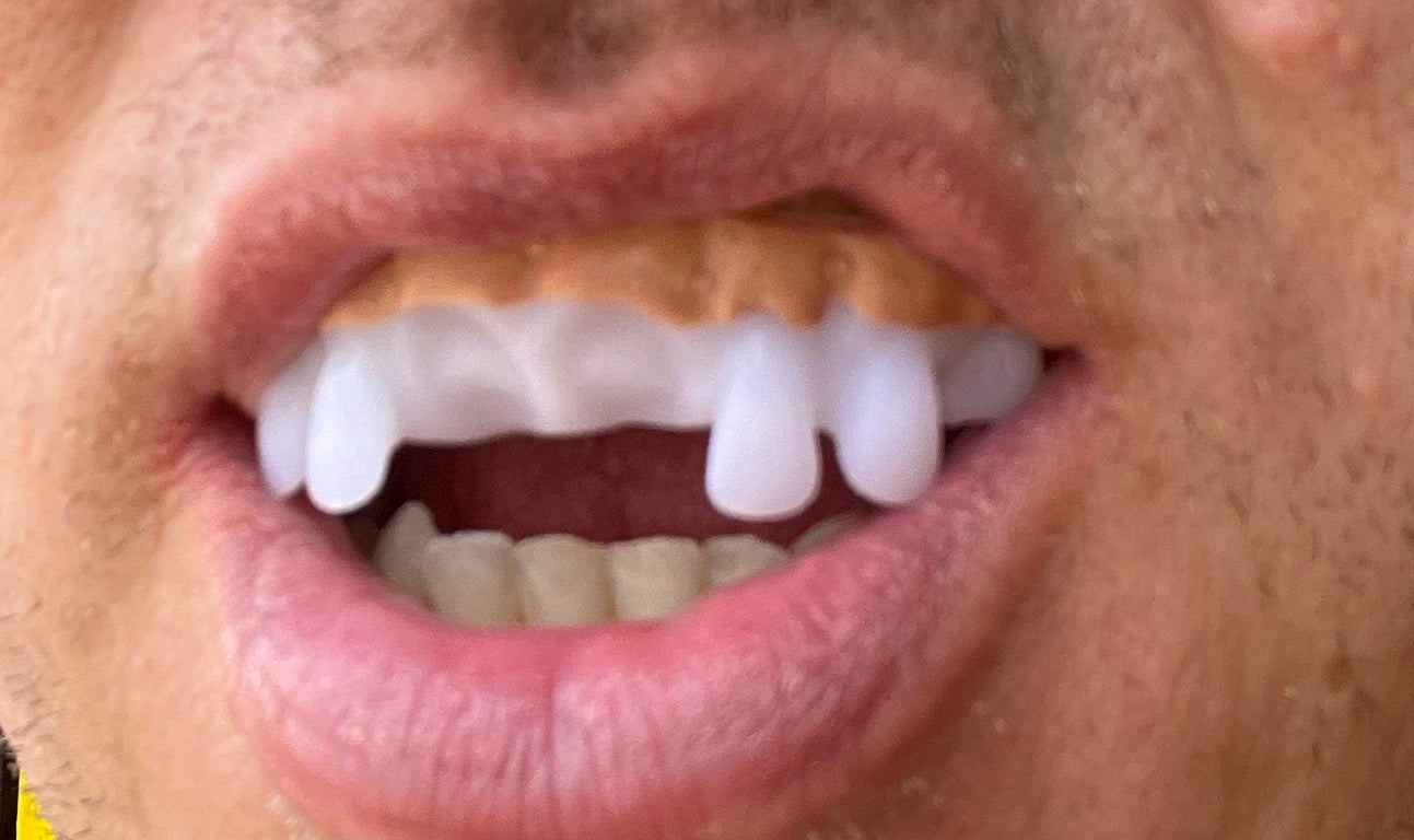 Assorted Teeth & Fangs (9 Pack)